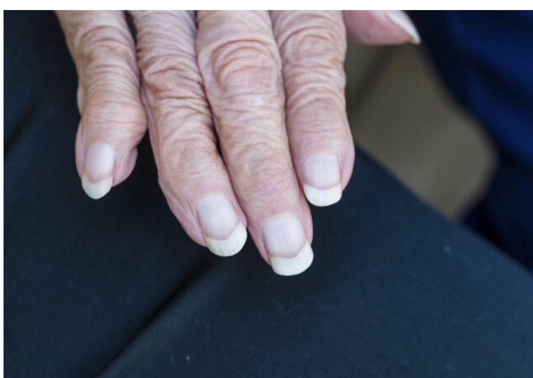 Fingernail Trimming & Filing