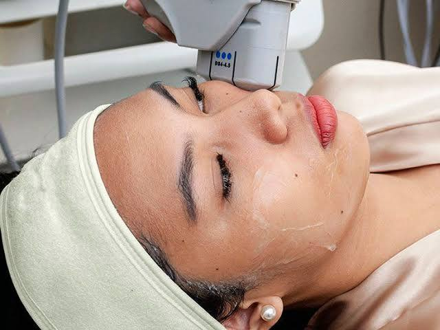 HIFU Skin Lifting